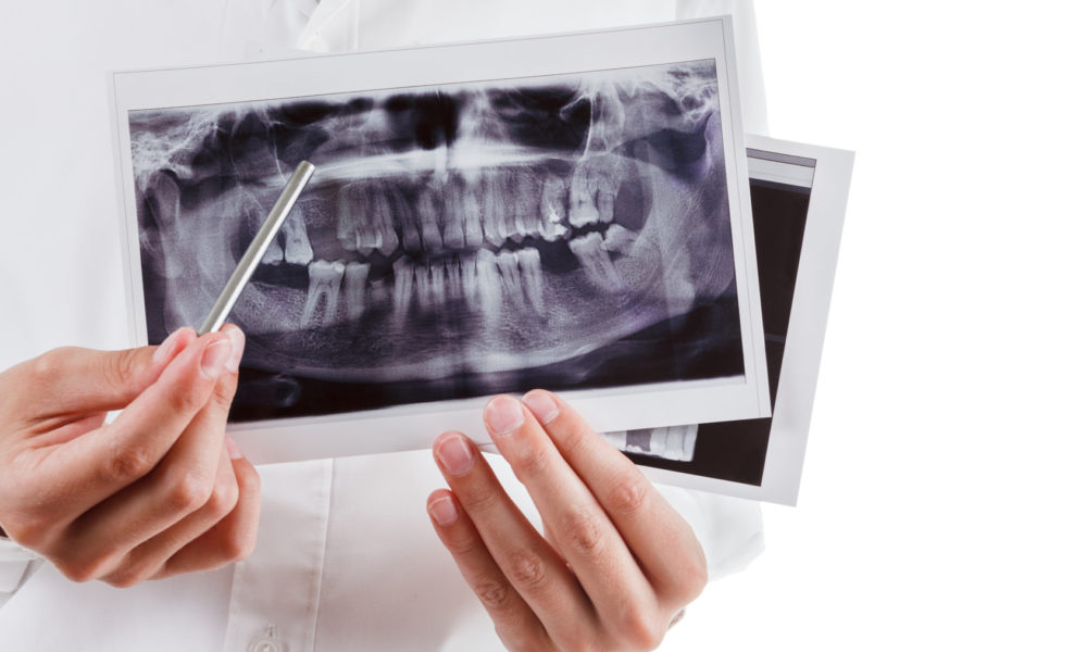 pantomogram warszawa